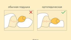 Как выбрать оптимальную поддержку в Gipfel