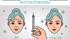 Применение нитей в различных сферах деятельности в Gipfel